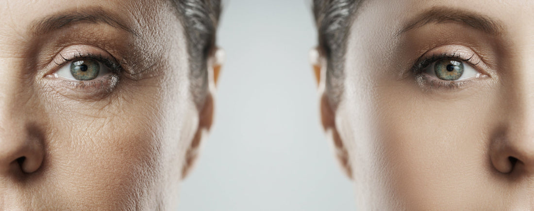 5 Common Signs of Aging and How to Support Your Skin Through Them
