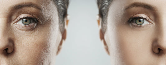 5 Common Signs of Aging and How to Support Your Skin Through Them