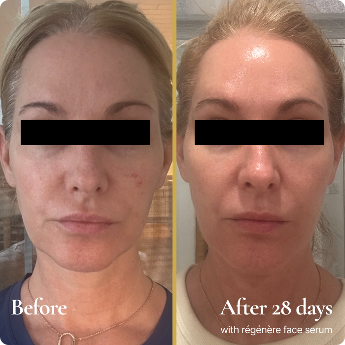 Régénère Customized Serum