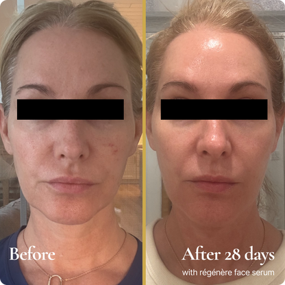 Régénère Customized Serum